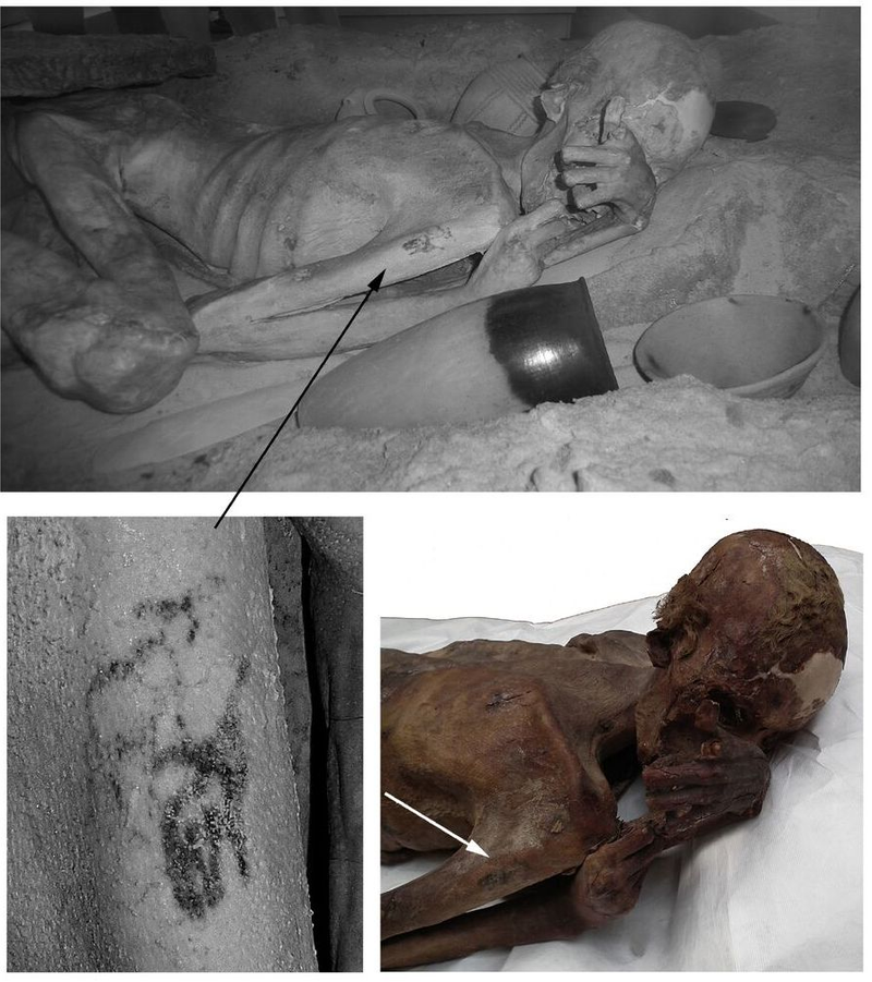 Top: Infrared image of Gebelein Man A. Lower left: tattoos seen on his right arm under infrared light. Lower right: The mummy and tattoos under normal lighting conditions.